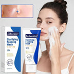 Foaming Wash Facial Cleanser Deep Cleaning Oil-Control Moisturizing Gentle Formula - princesszohal