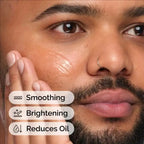 Niacinamide Serum Essence Suitable for Acne-prone Skin Which Can Smooth Brighten Support The Skin - princesszohal