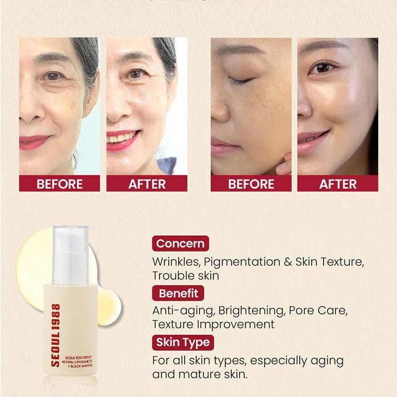 Korean SEOUL 1988 Retinol Face Serum Fade Fine Wrinkle Moisturizing Whitening - princesszohal