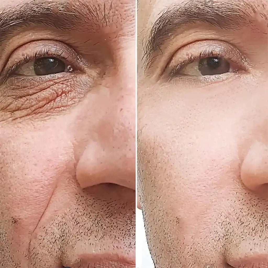 Retinol Anti-wrinkle Cream For Men Collagen Anti-Aging Removal Face Neck Wrinkle Efficient Moisturizing Firming Korean Skin Care - princesszohal