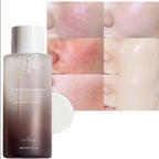 Haruharu Wonder Black Rice Toner Remove Acne Face Serum Moisturize Skin Rejuvenating Hyaluronic Acid princesszohal