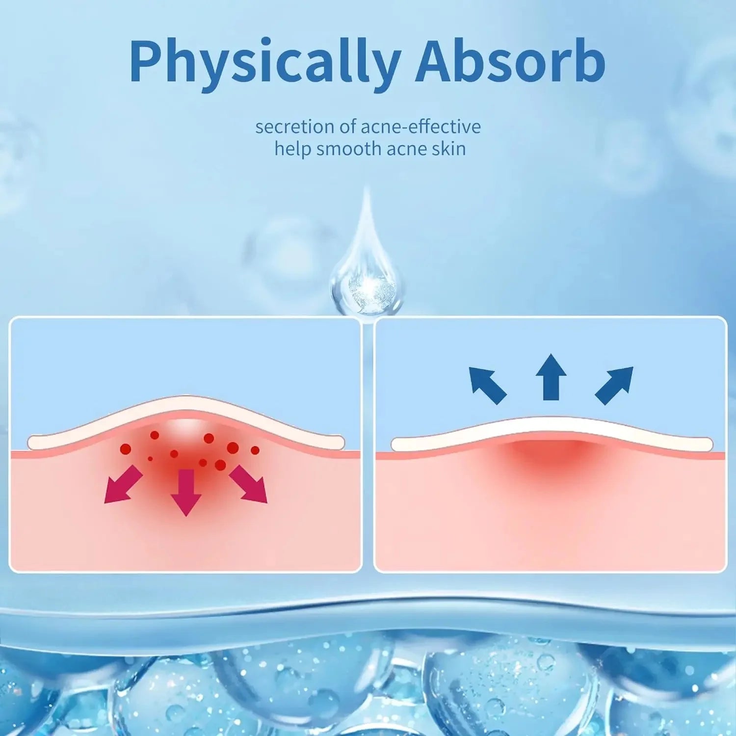 180/360PCS Invisible Acne Veneer Lump Sticker Reduce Acne Cleansing Pores Oil Removal Repair and Smooth Skin Facial Products Var