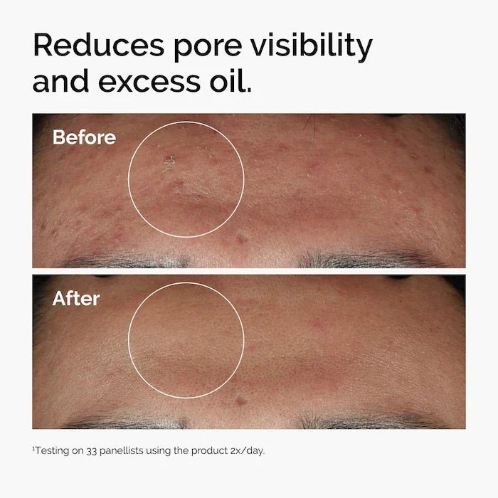 Niacinamide Serum Enhance Skin Brightness Improve Texture Reduce Excess Oil Strengthen Skin Moisture Barrier - princesszohal