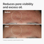 Niacinamide Serum Essence Suitable for Acne-prone Skin Which Can Smooth Brighten Support The Skin - princesszohal