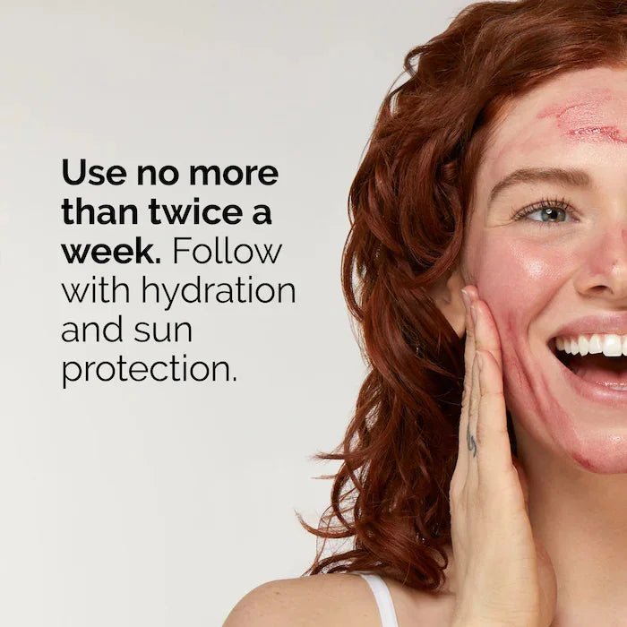 AHA Peeling Solution exfoliating facial brighten Smooth and refine the appearance of skin - princesszohal