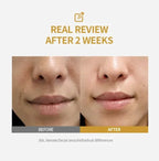 Dark Spots Corrector Repair Serum Korean Skin Care