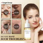 Sensitive Skin Comfort Serum 55ml - Madagascar Centella Formula Calms, Soothes & Deeply Moisturizes  - princesszohal