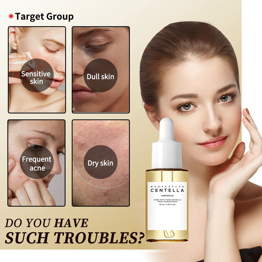 Sensitive Skin Comfort Serum 55ml - Madagascar Centella Formula Calms, Soothes & Deeply Moisturizes for Daily Skin Care Support.