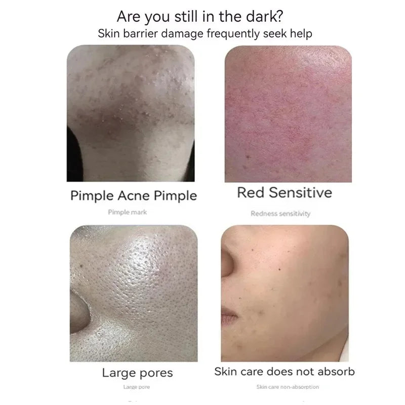 Blue Copper Scar & Line Repair