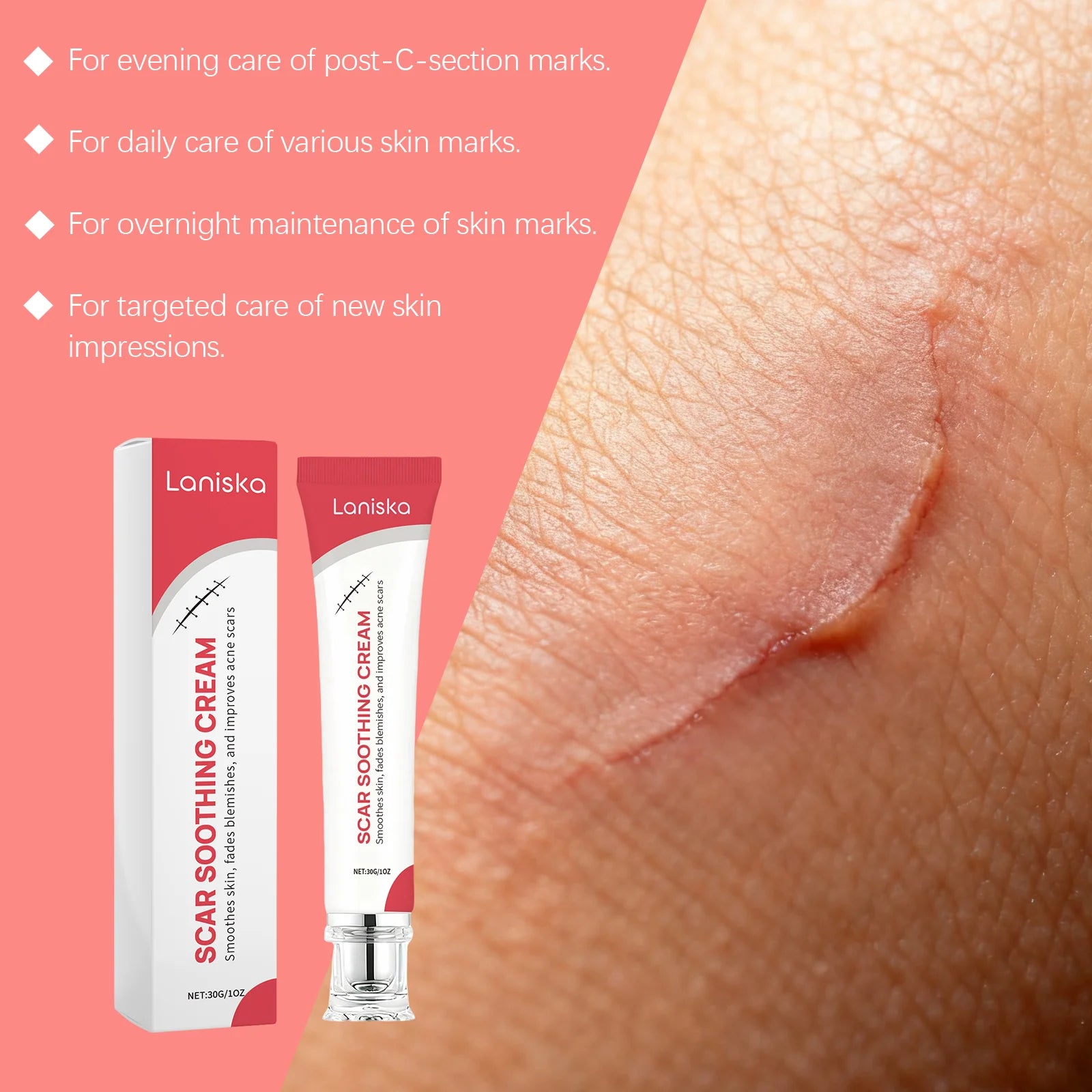 Skin Care Cream Gentle Nourishing Smooth Care for Soft Body Skin Daily Care Cream