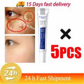 Powerful Spot-Removing Whiten Cream Brighten Skin Fast Eliminates Melanin Pigmentation Melasma Dark Spots Korean Face Skin Care